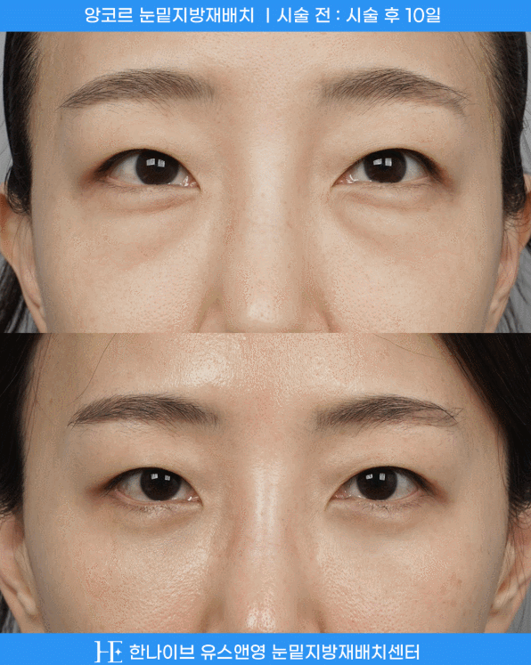 uploaded_6a8541d99488e.gif