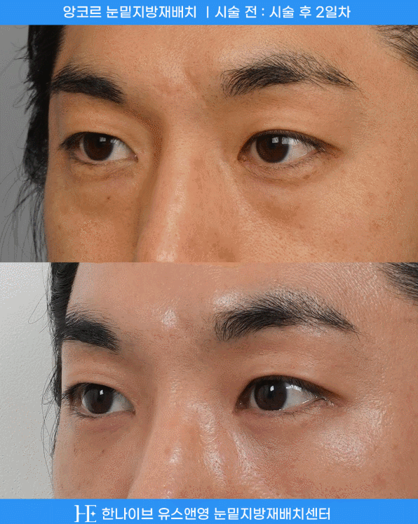 uploaded_6a8541d9ac4c8.gif