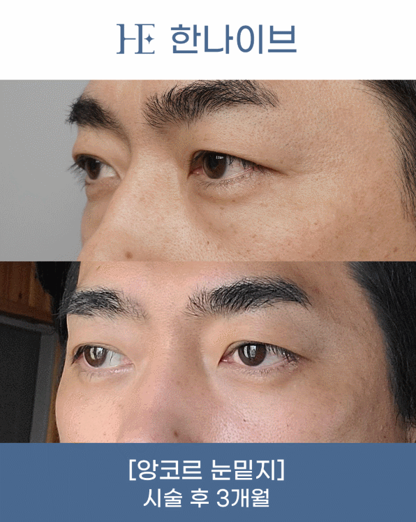uploaded_6a8542ad4208e.gif