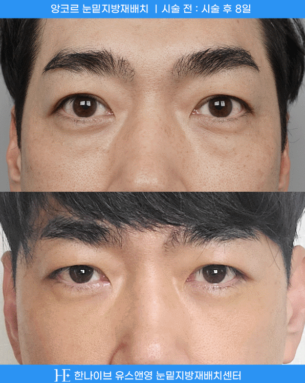uploaded_6a8542bc031e9.gif