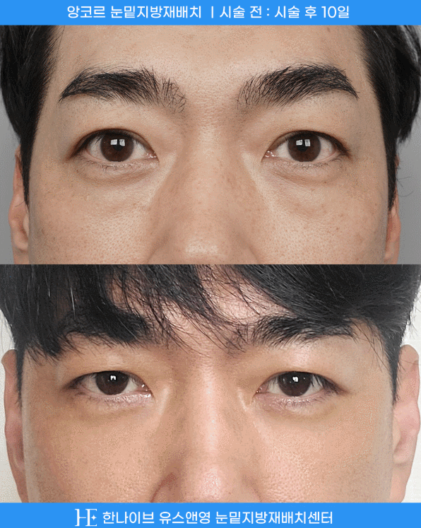 uploaded_6a85437e9aeed.gif