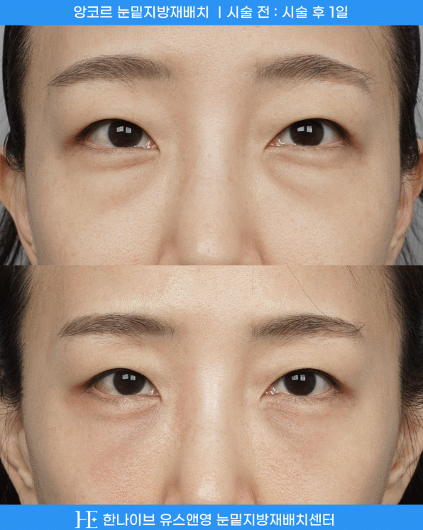 uploaded_6a854482b504f.gif