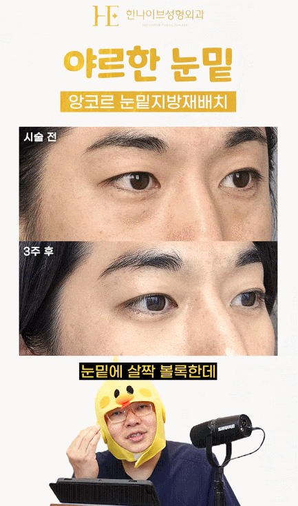 uploaded_6aa0b3254014a.gif