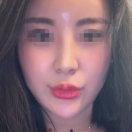 정면 후