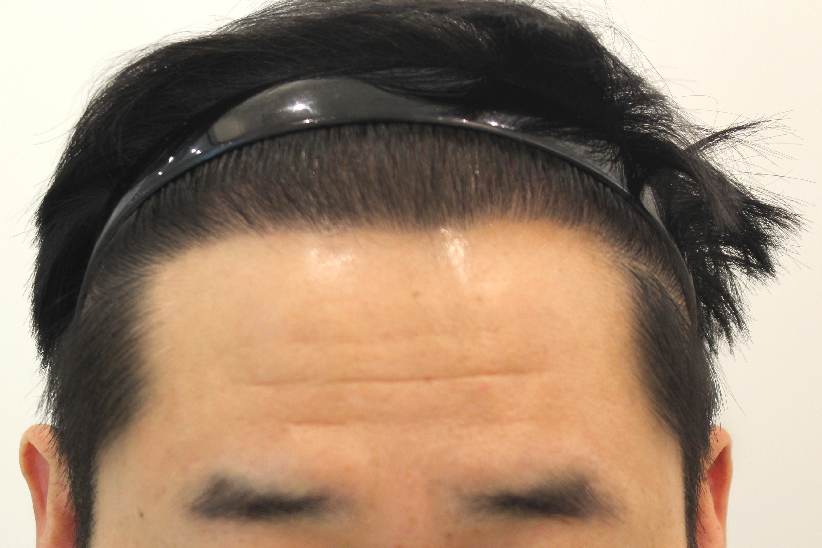 정면 후