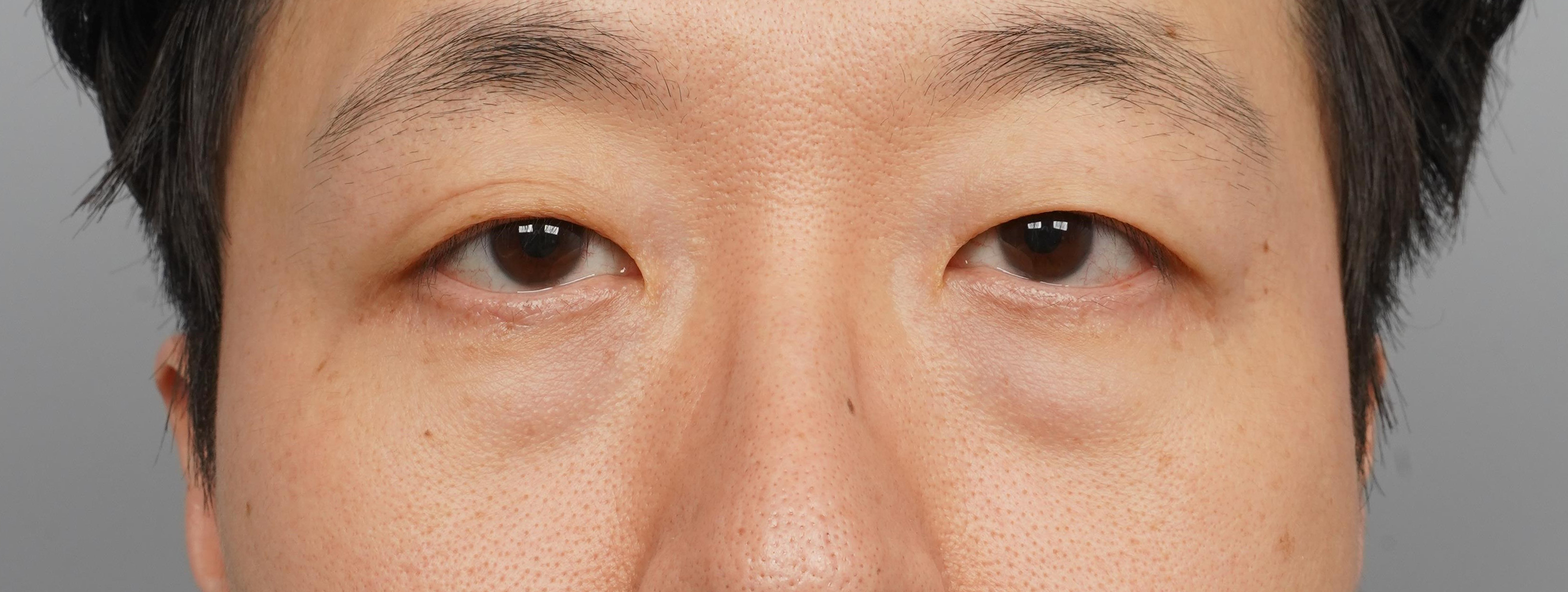 정면 전