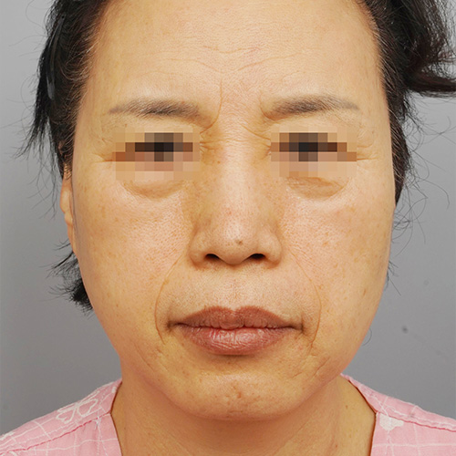 정면 전