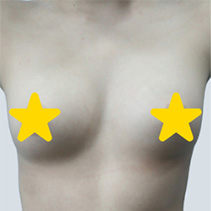 정면 전
