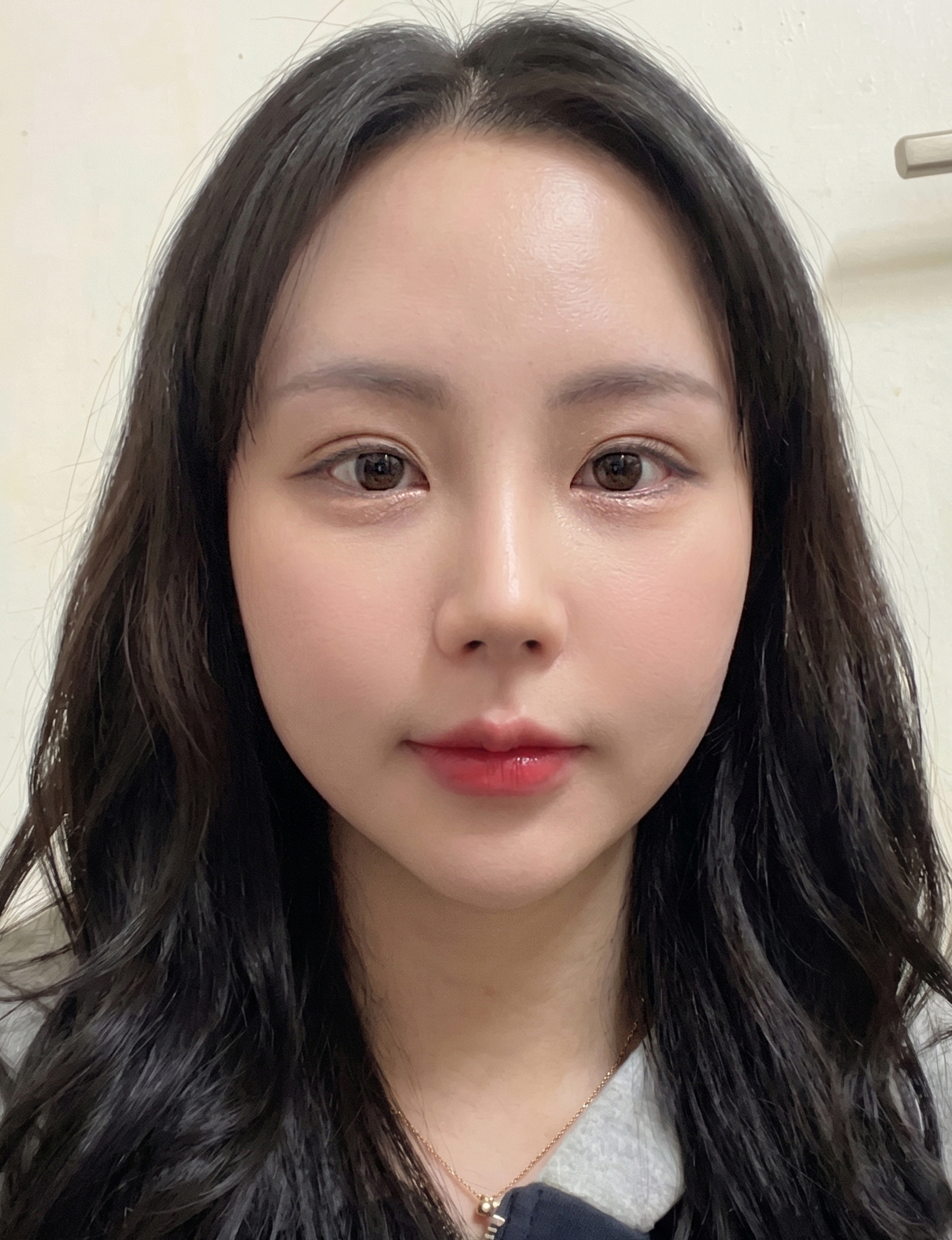 정면 후