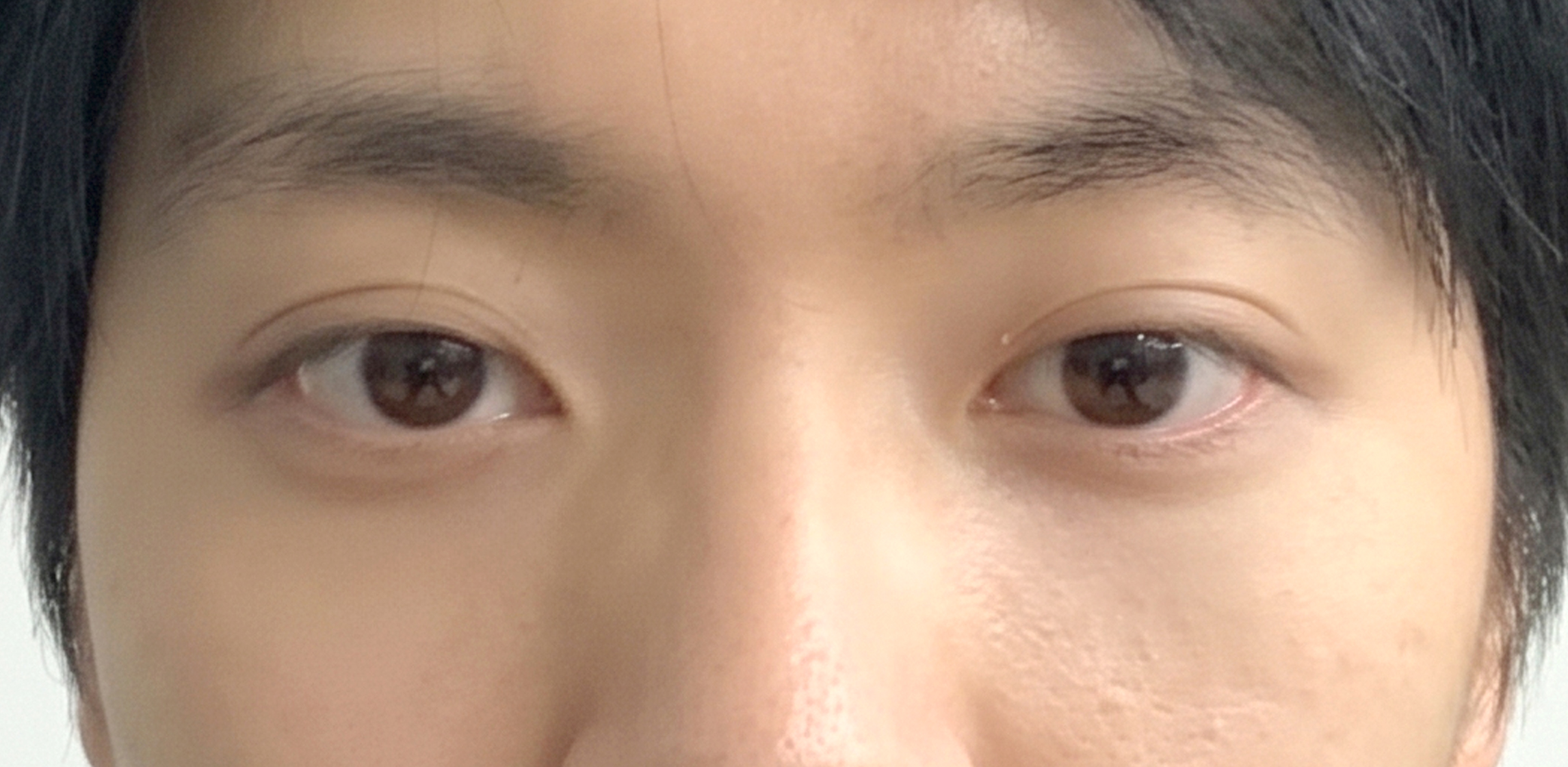 정면 후
