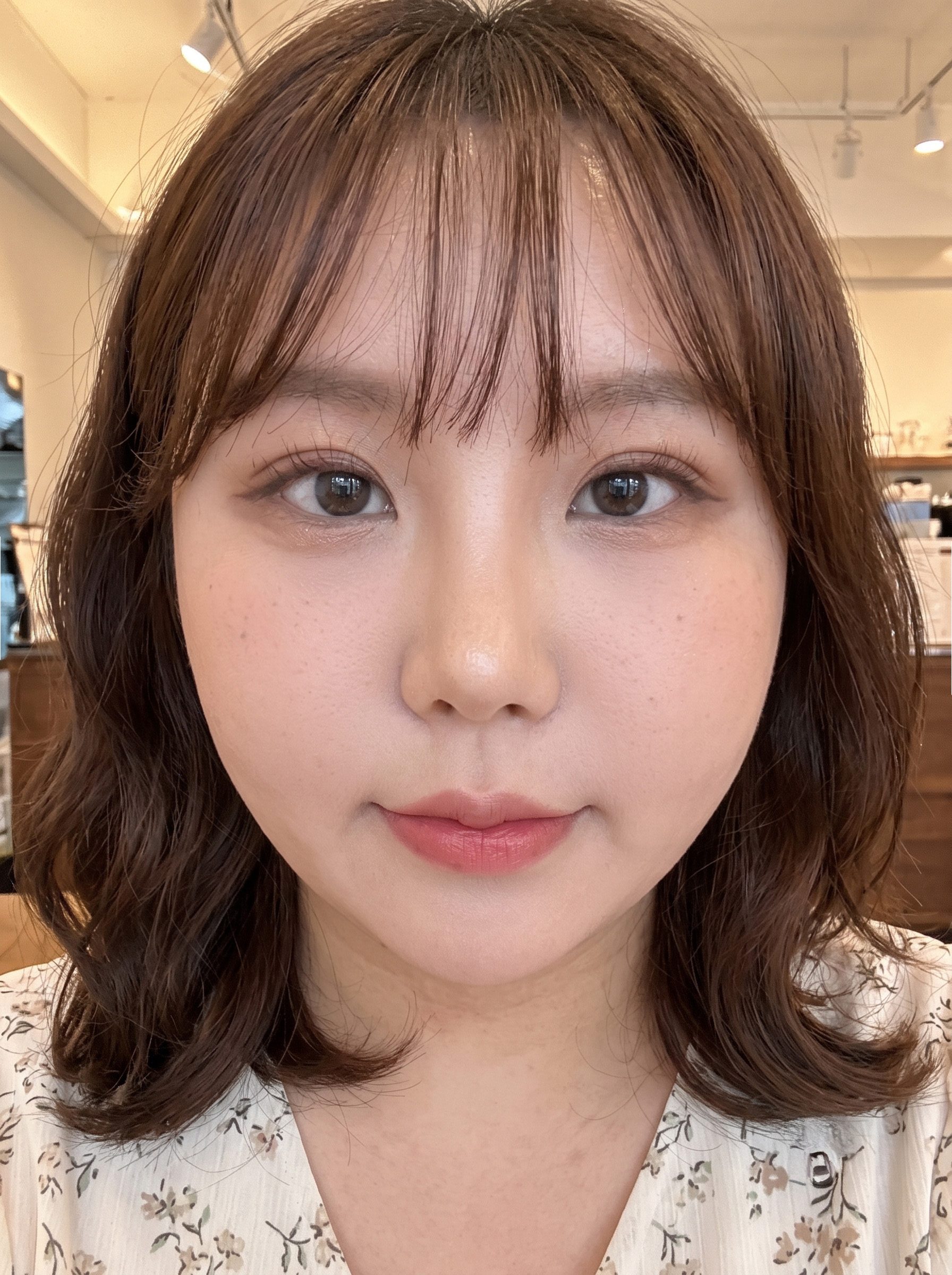 정면 후