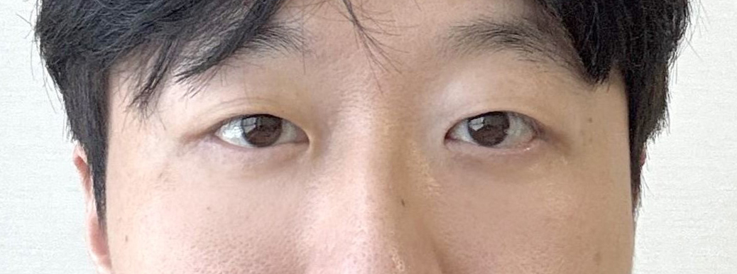 정면 후
