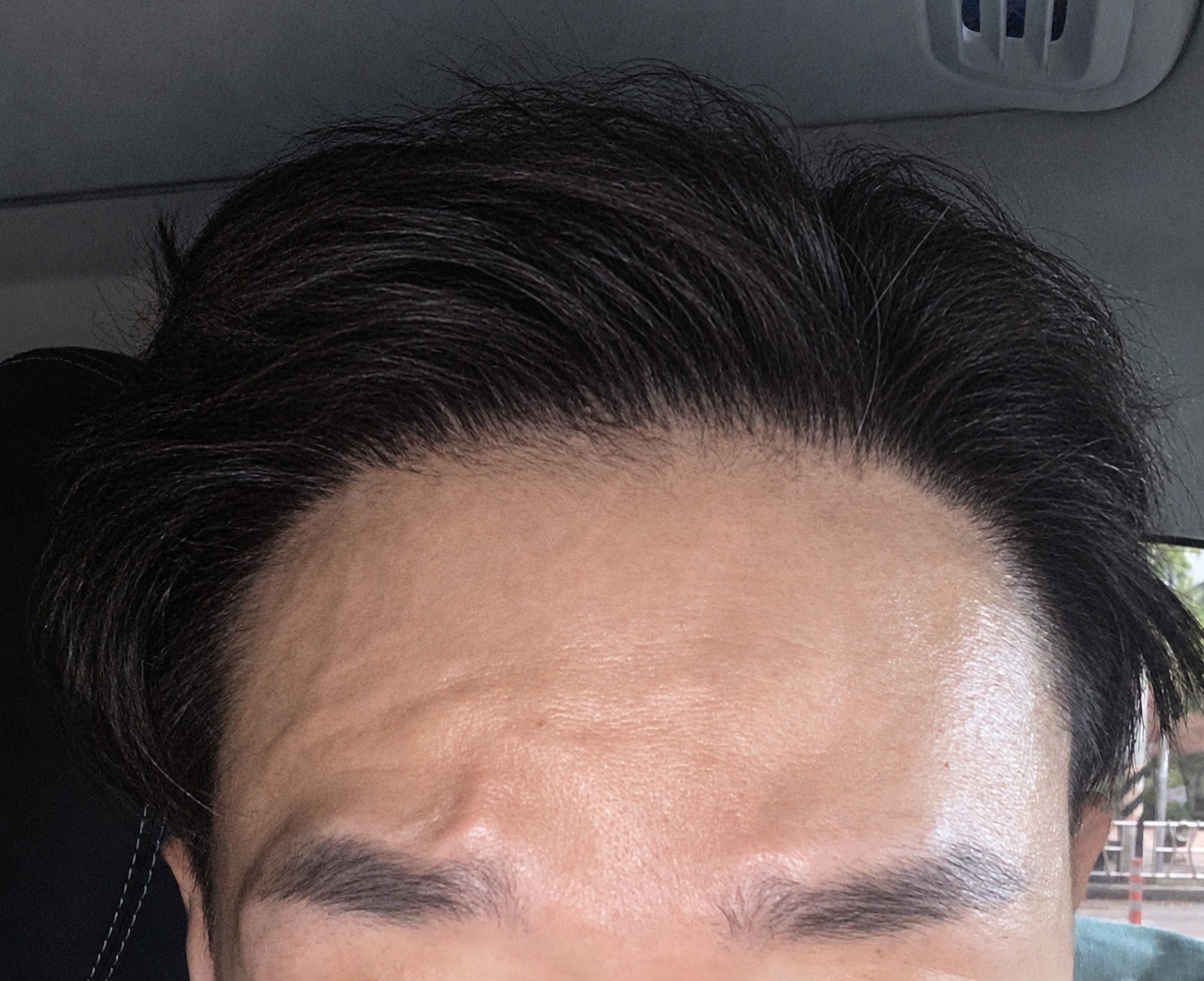 정면 후