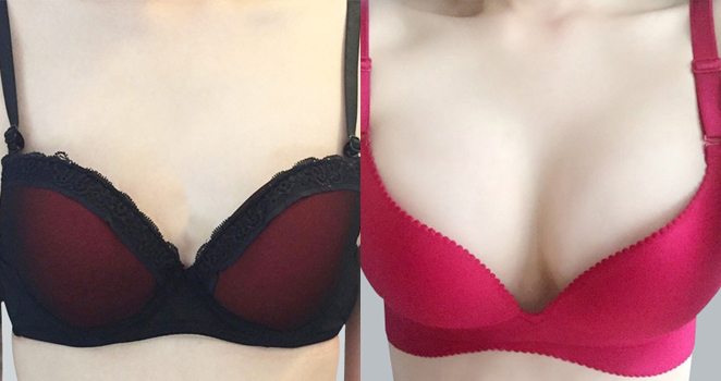 멘토라운드 325cc