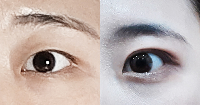 자연유착