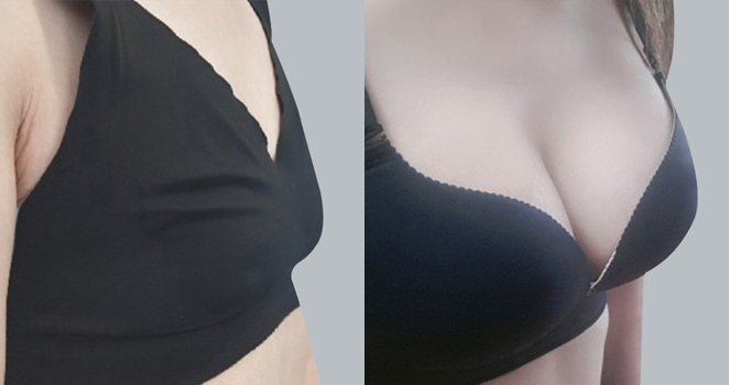멘토라운드 325cc
