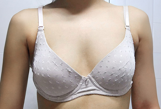 수술 전