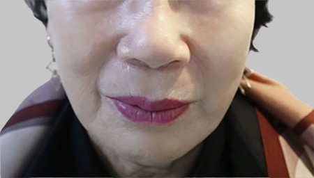 미니거상 2주 후