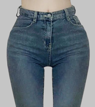 골반 필러 시술 후