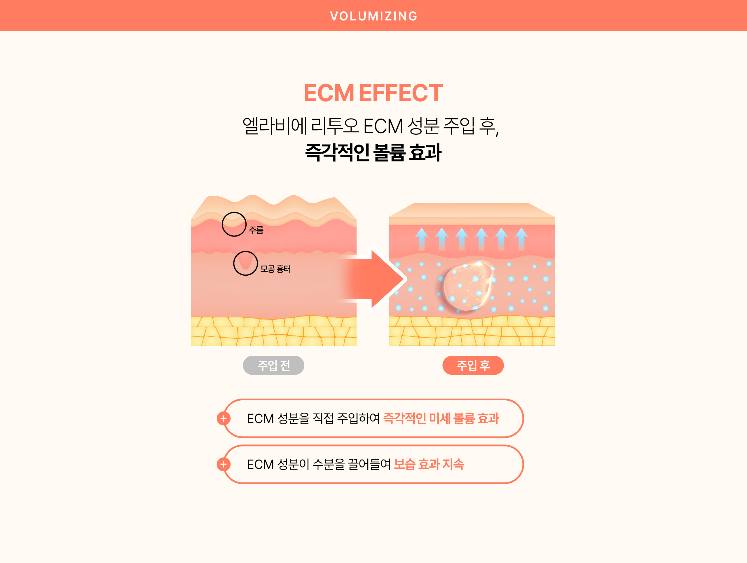 즉각적인볼륨효과