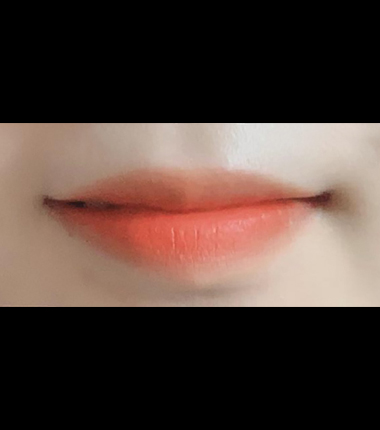 시술전