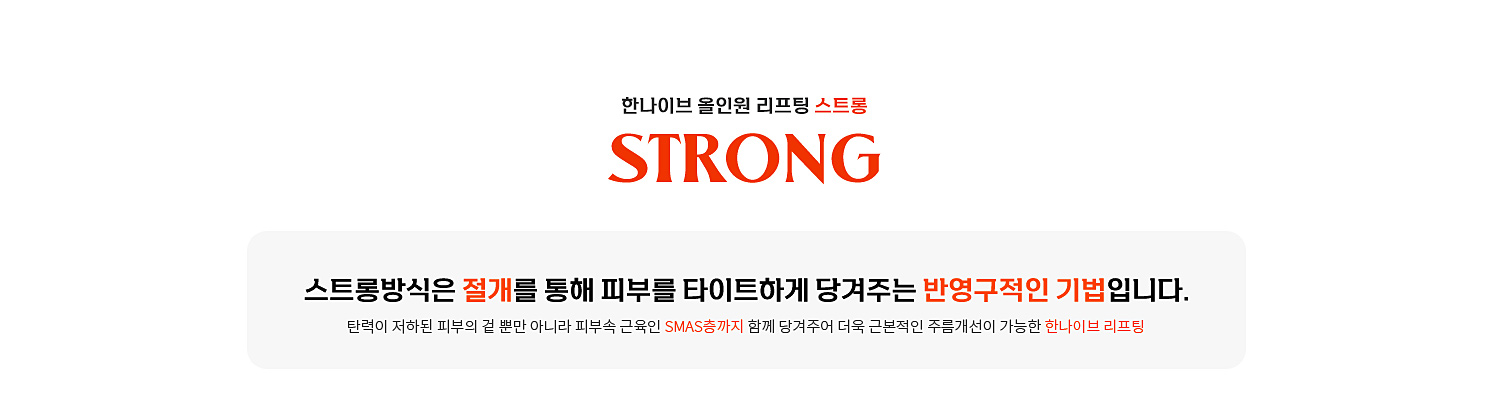 스트롱방식이란?