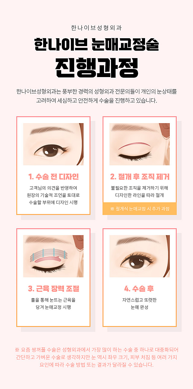 한나이브눈매교정술진행과정