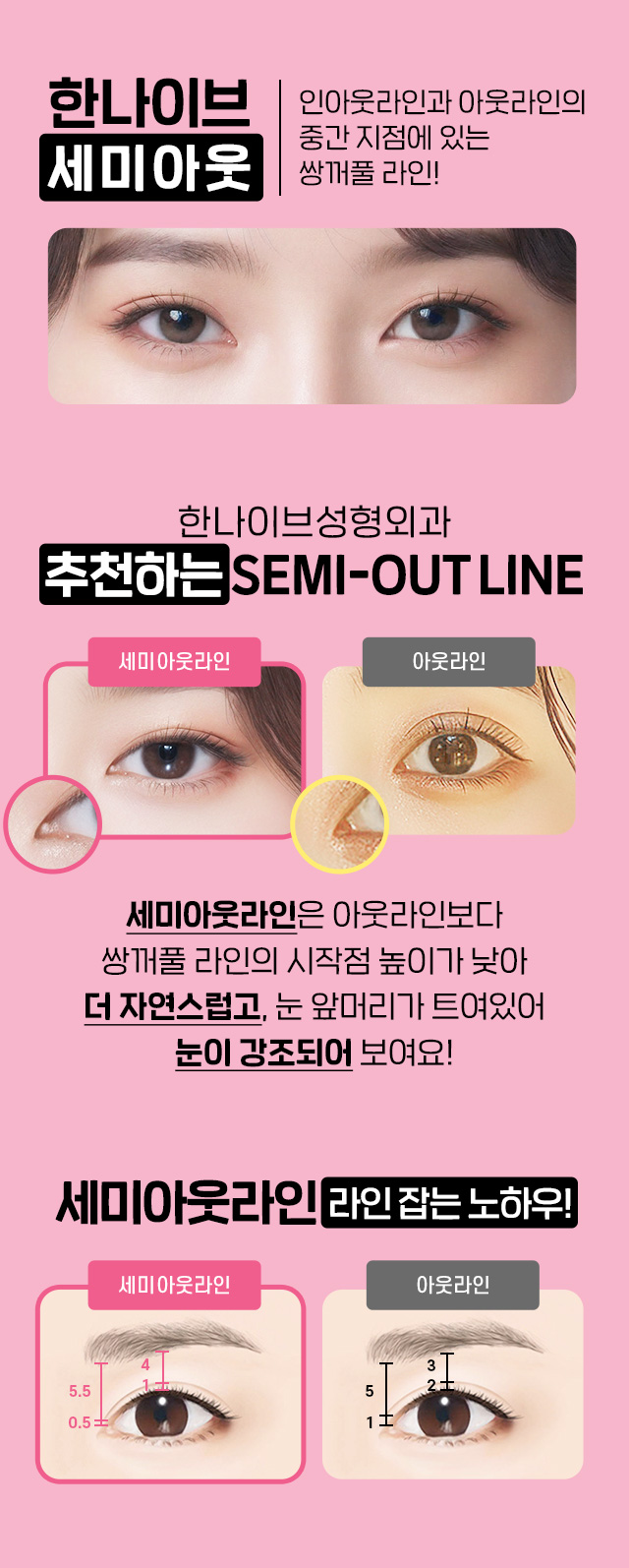 추천및노하우