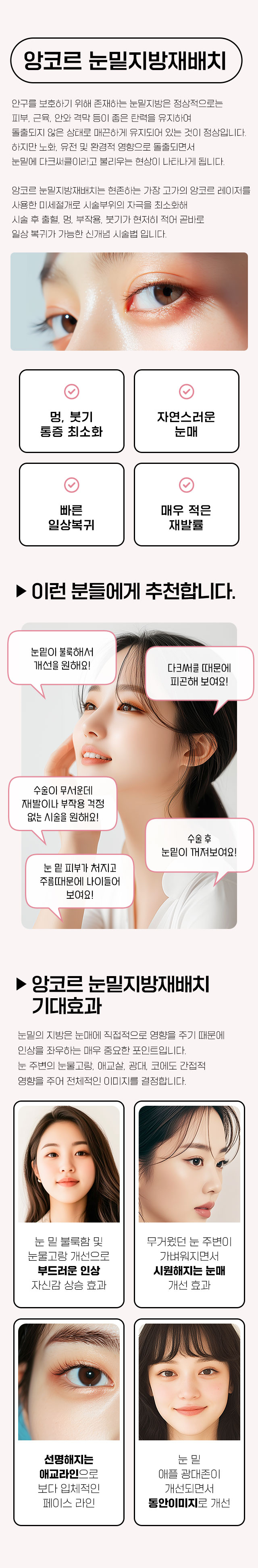 앙코르눈밑지방재배치