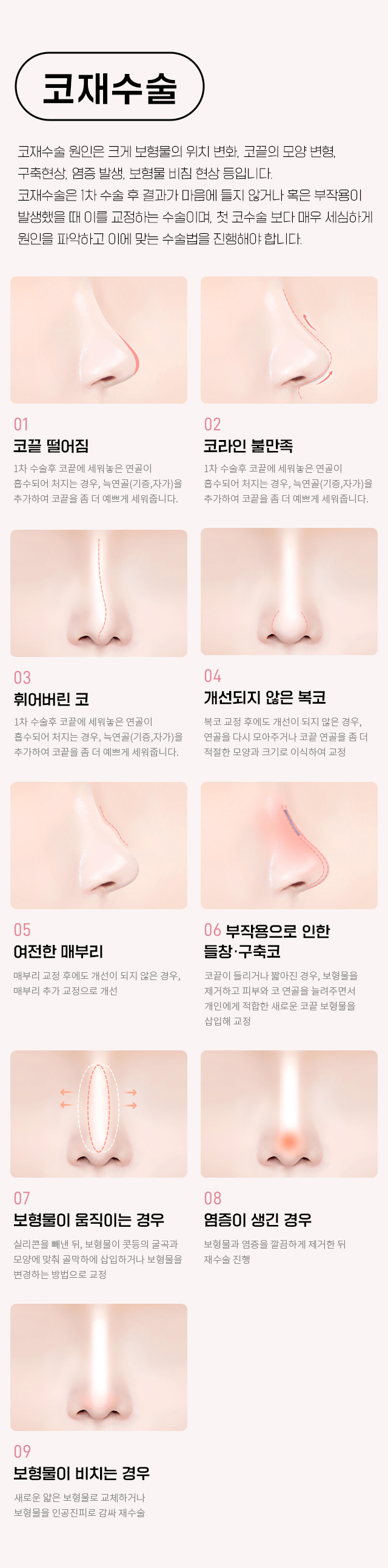 한나이브코재수술