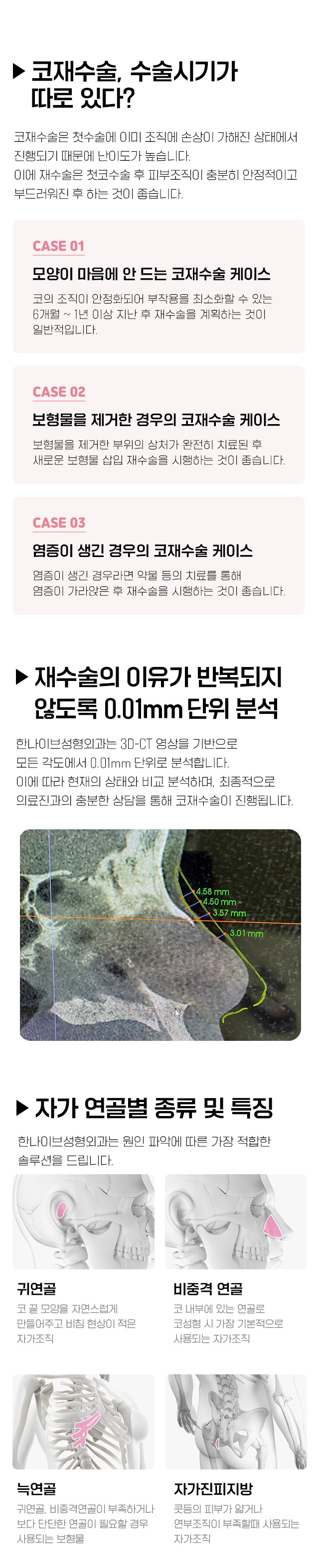코재수술수술정보