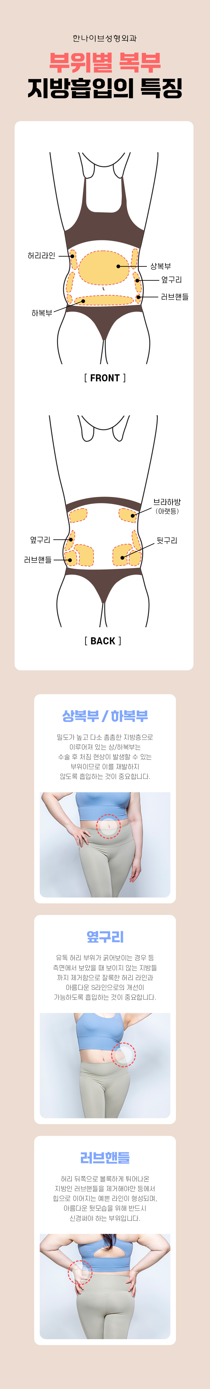 부위별복부지방흡입특징