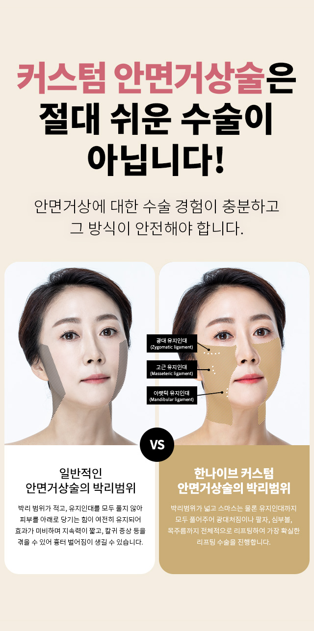 안면거상술은쉬운수술이아닙니다