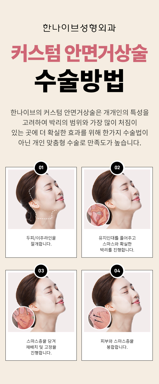 커스텀안면거상술수술방법