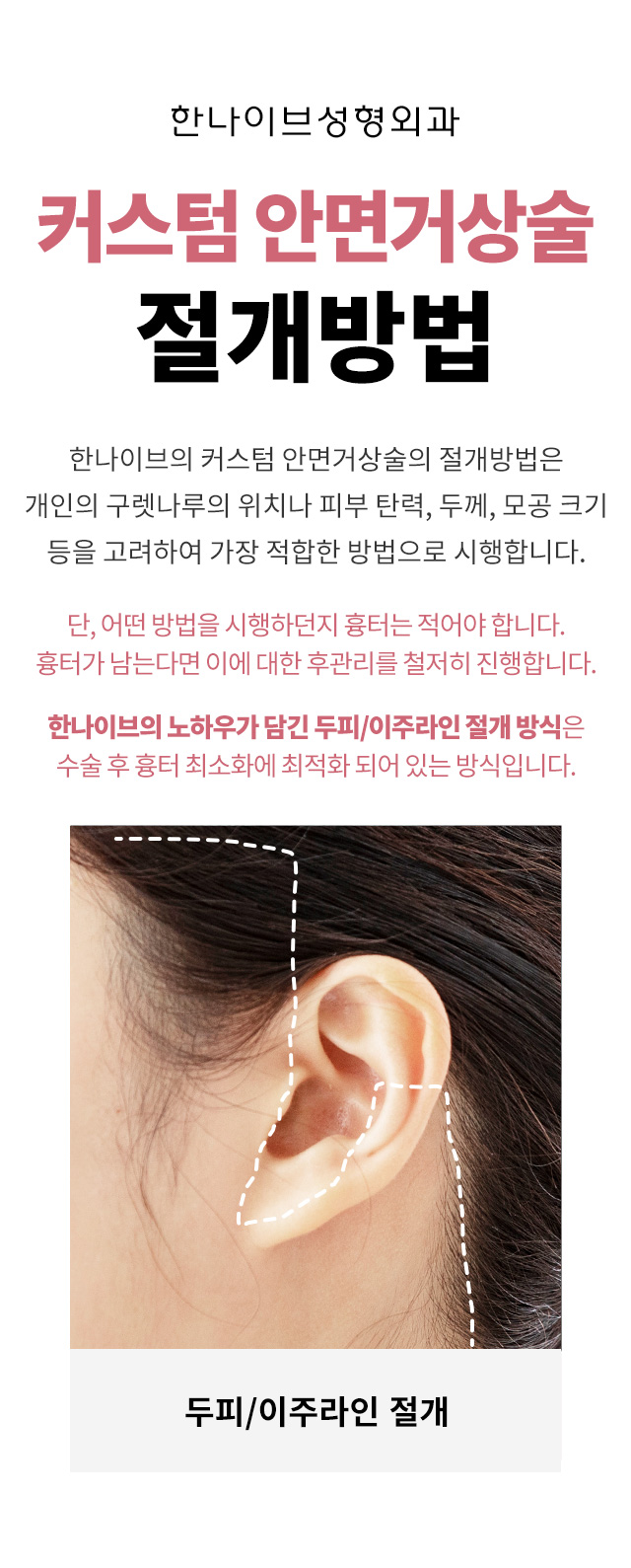 커스텀안면거상술절개방법
