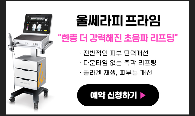 울쎄라피프라임특징