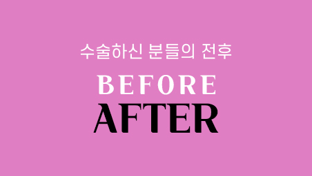전후사진